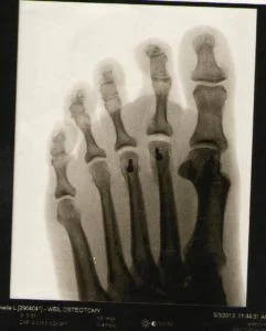 The Daily Adventures of the Skeleton Foot Skeleton Foot 241x300